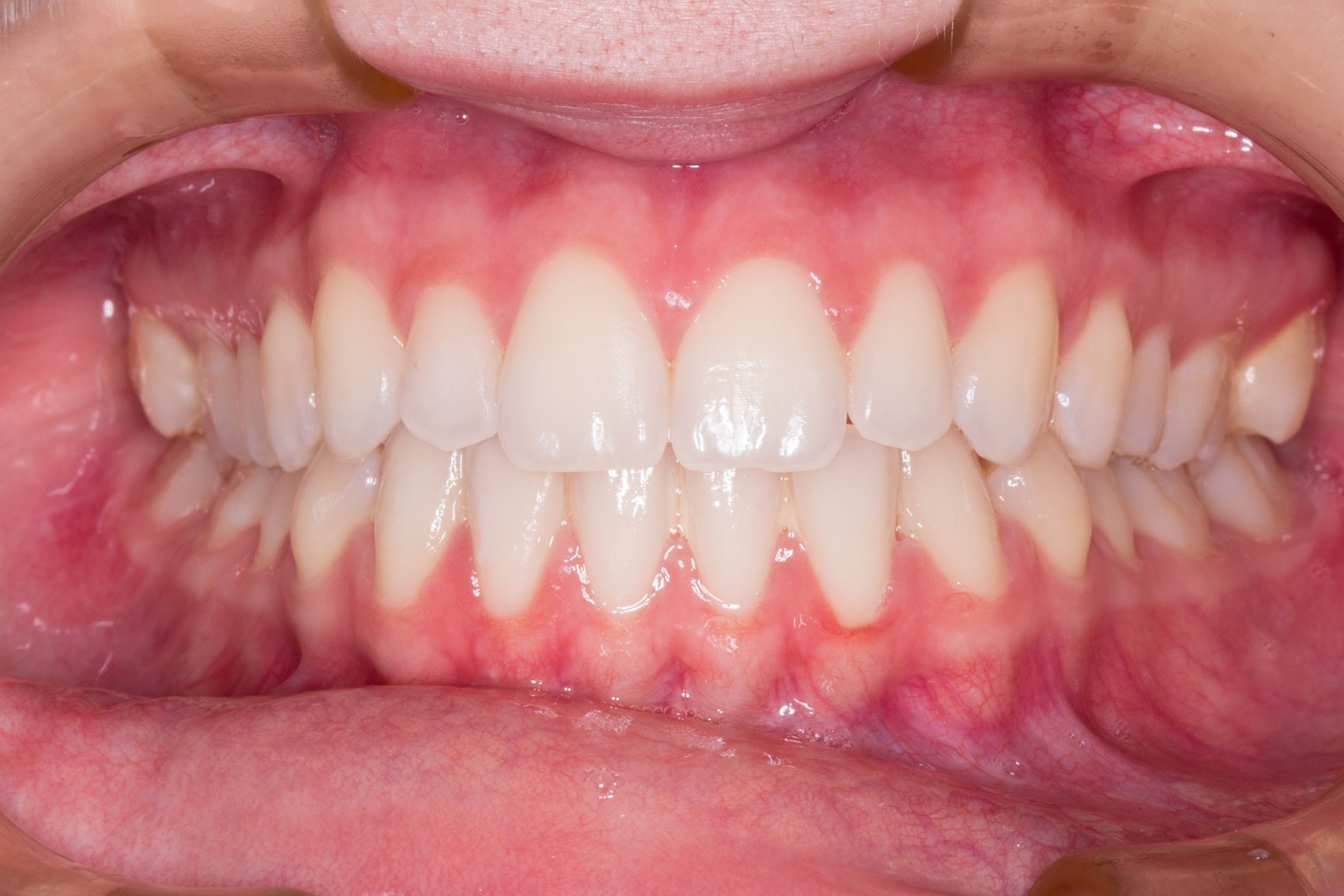 Global Implant Surgeons