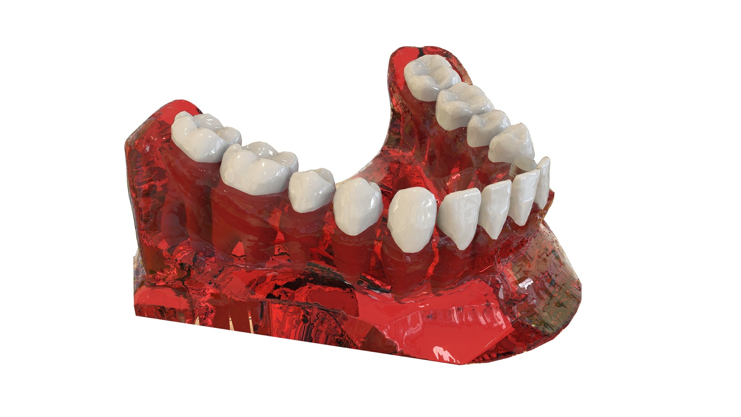 Toronto Denture Repairs