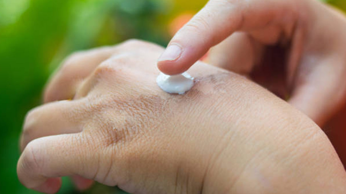 Pomadas no sanan lesiones