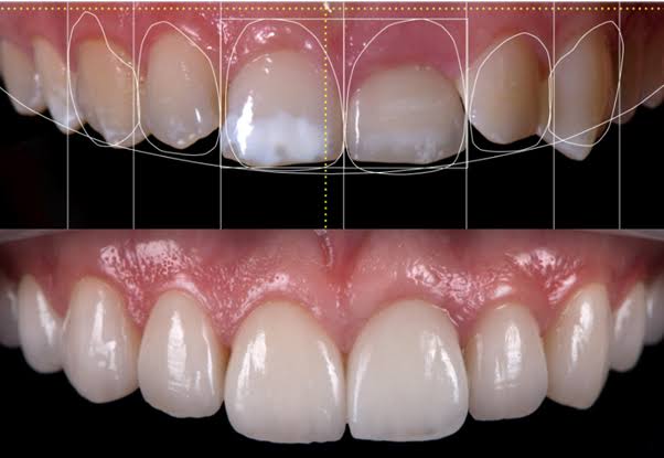Dentique Dental & Implant Centre| Dental Implant Specialist in Noida