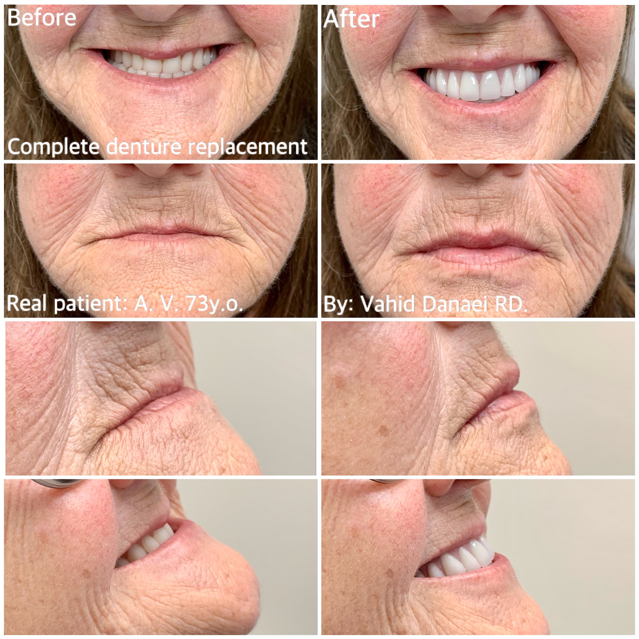 Complete Denture Clinic & Implant Centre