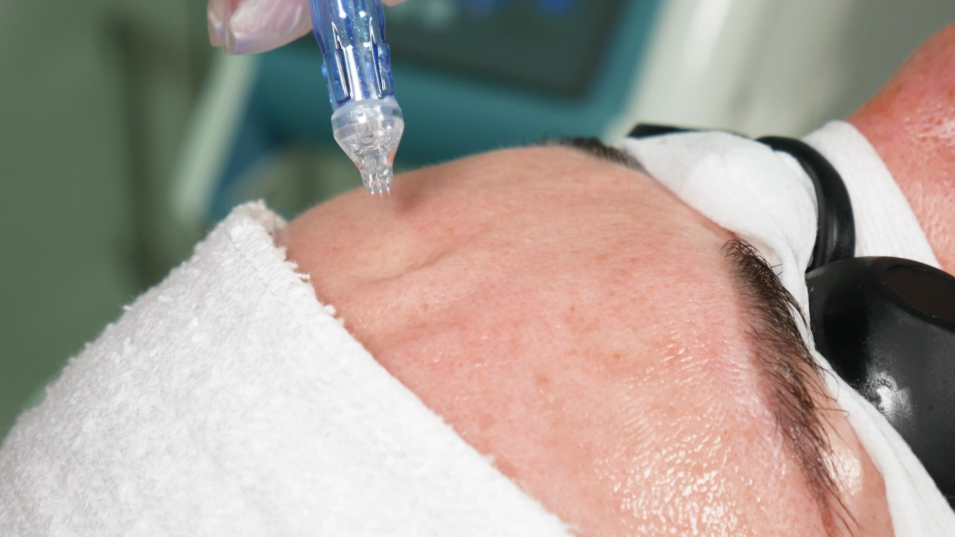 Skin Natural Laser Centre
