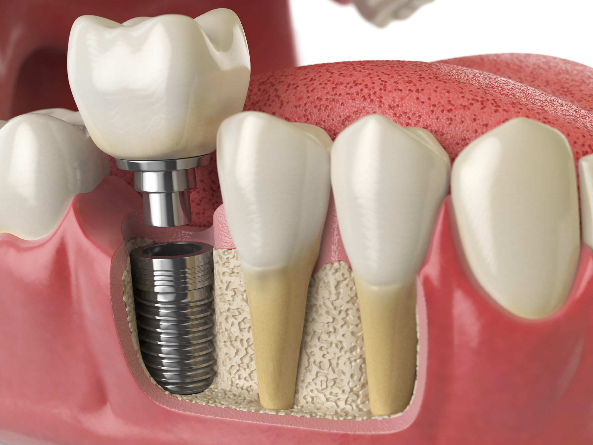 Divine Dental Dr Anirudh Rehani - Best Dentist | Dental Clinic | RCT Treatment | Dental Implant | Dental Braces In Rohini
