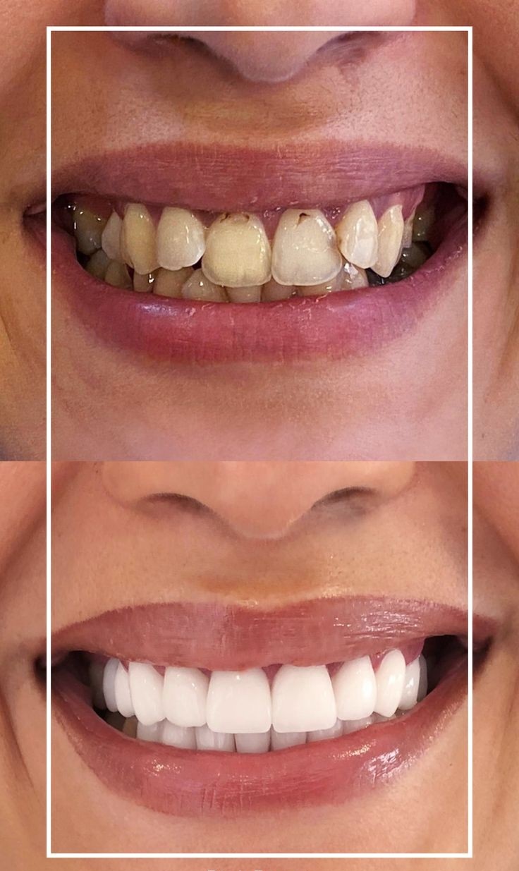 Dentique Dental & Implant Centre| Dental Implant Specialist in Noida