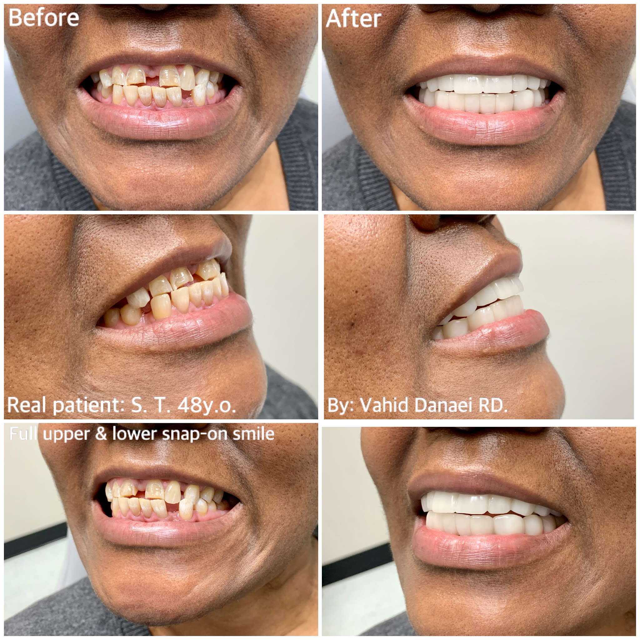 Complete Denture Clinic & Implant Centre