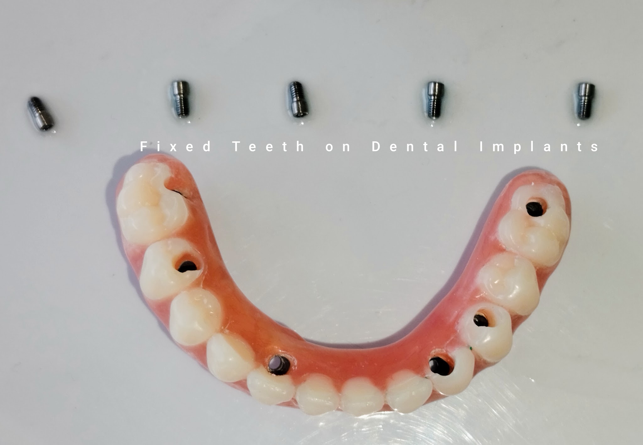 Divine Dental Dr Anirudh Rehani - Best Dentist | Dental Clinic | RCT Treatment | Dental Implant | Dental Braces In Rohini