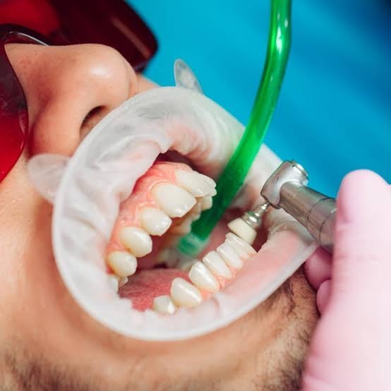 GRACIOUS SMILZ DENTAL CLINIC /ADVANCED MULTISPECIALITY DENTISTRY/ SINCE 2013/DENTAL IMPLANTS/ INVISALIGN ALIGNERS