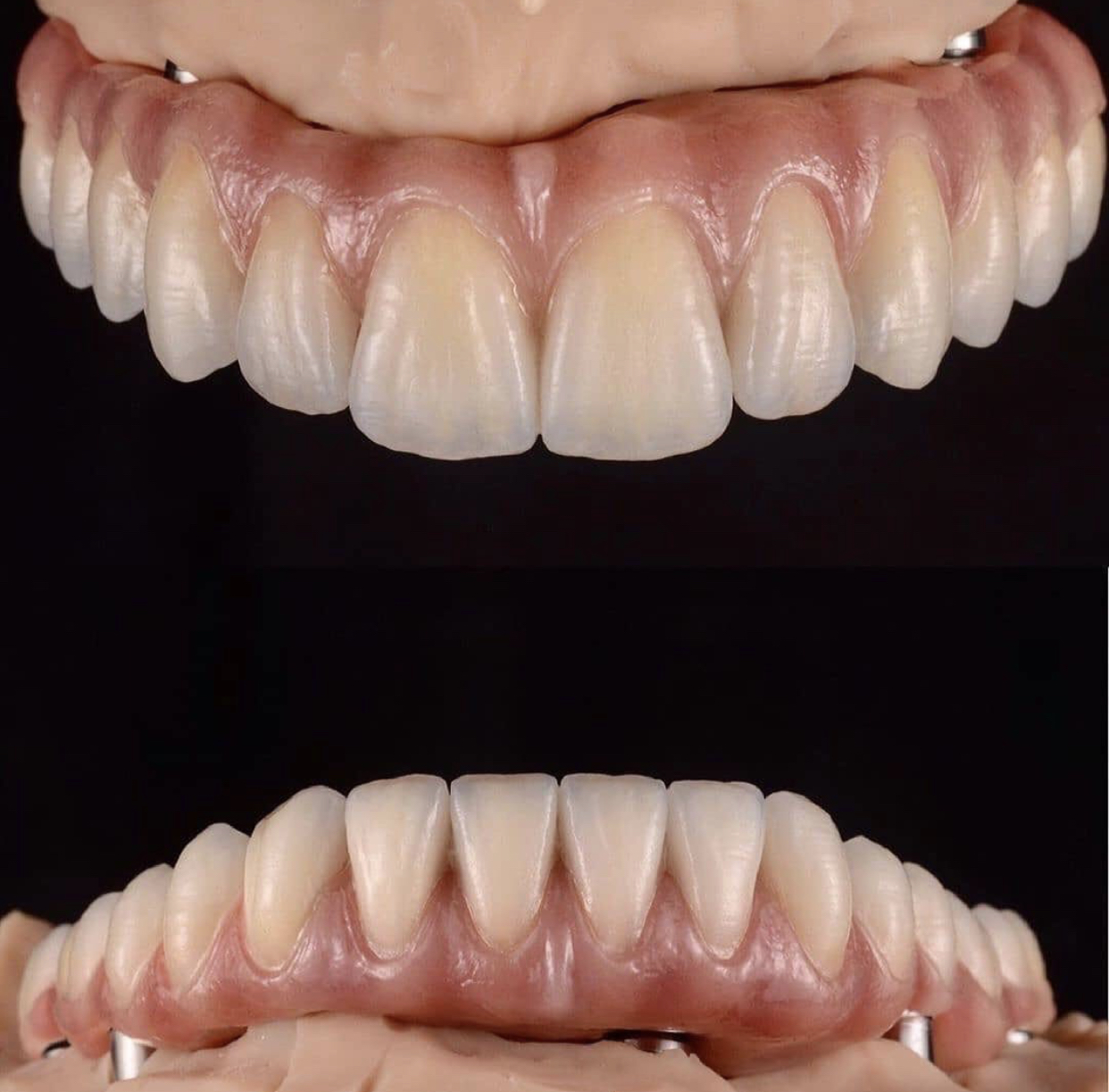 Zaitouni Denture Clinic