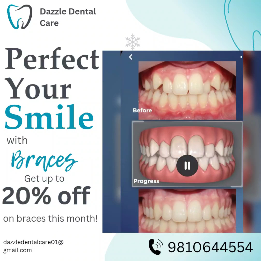 Dazzle Dental Care Specialist in RCT and Dental Implant