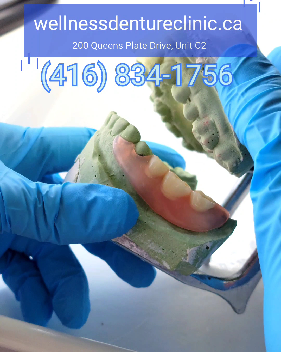 Wellness Mobile Dentures