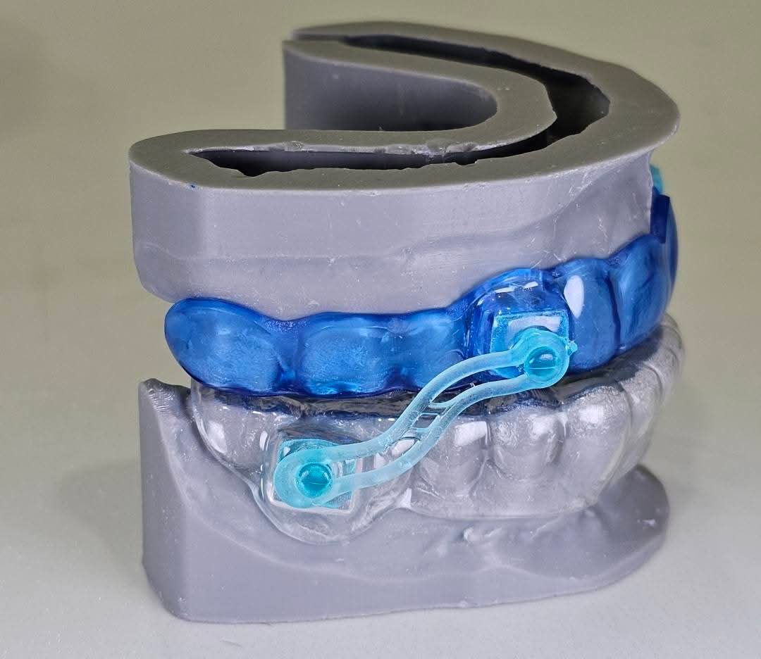 Dentique Dental & Implant Centre| Dental Implant Specialist in Noida