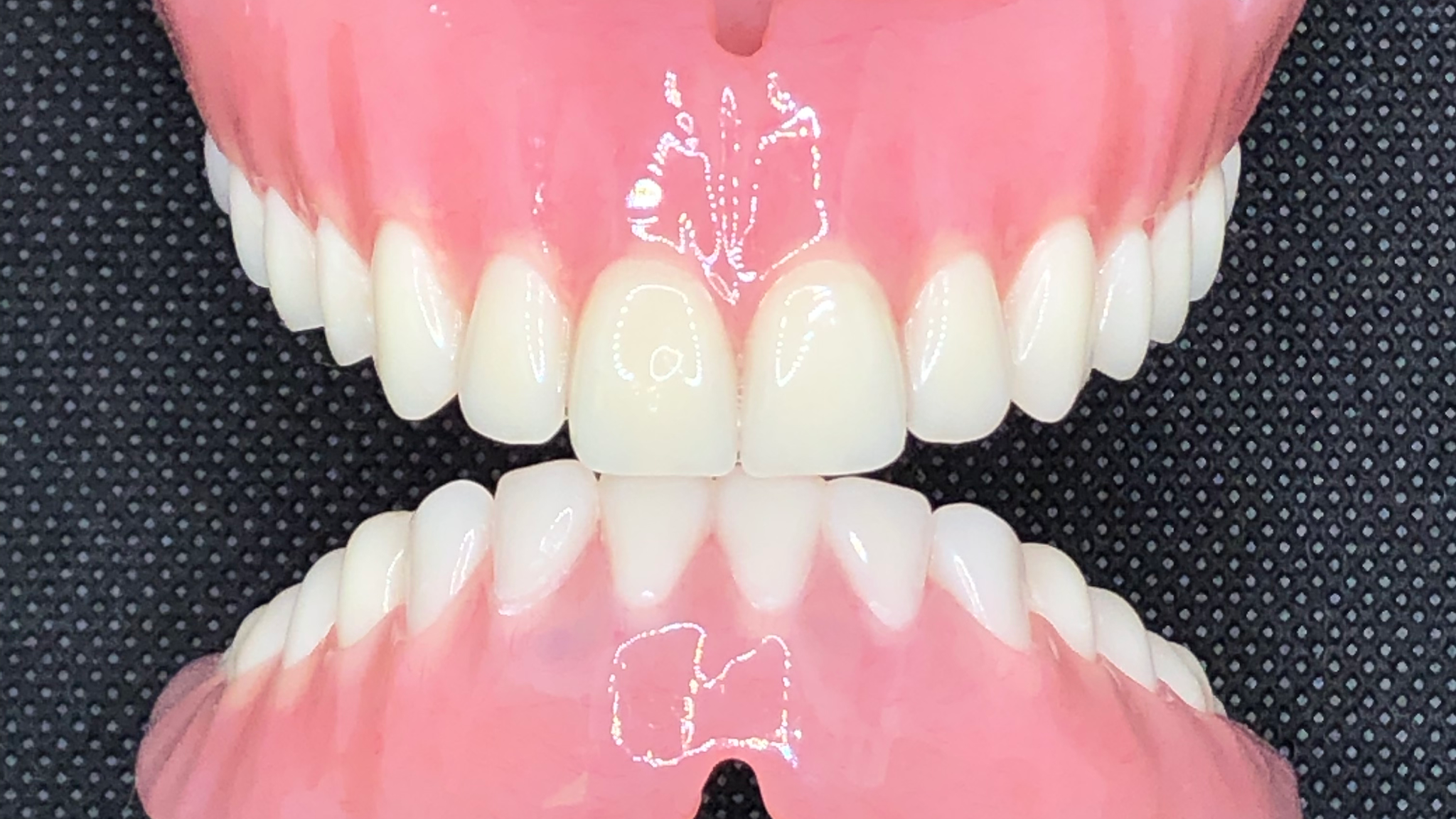ToothFitters Denture Clinic