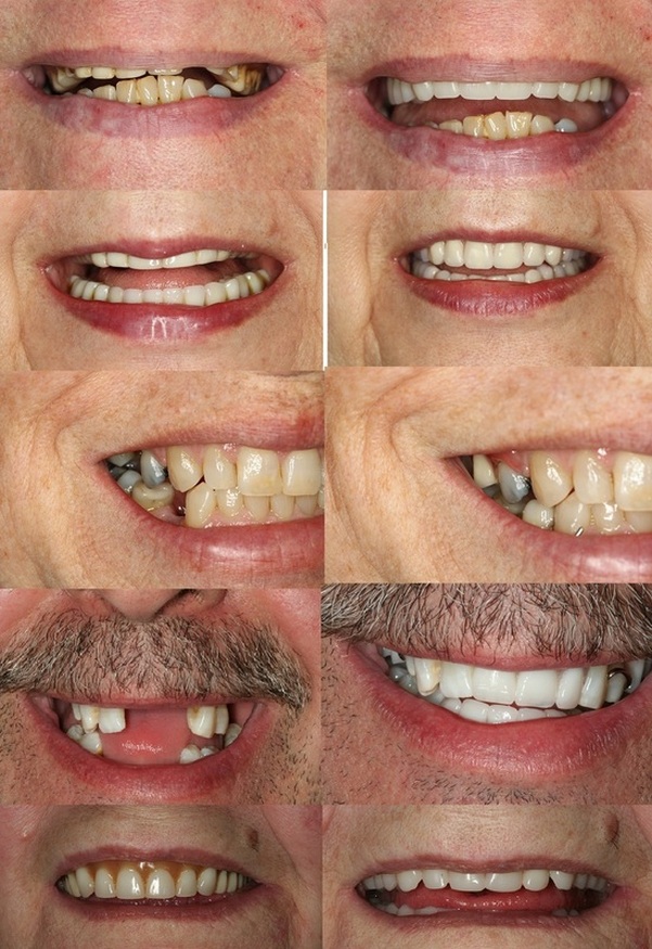 Sergey Haletski, DD | Mobile at-home Denture Clinic