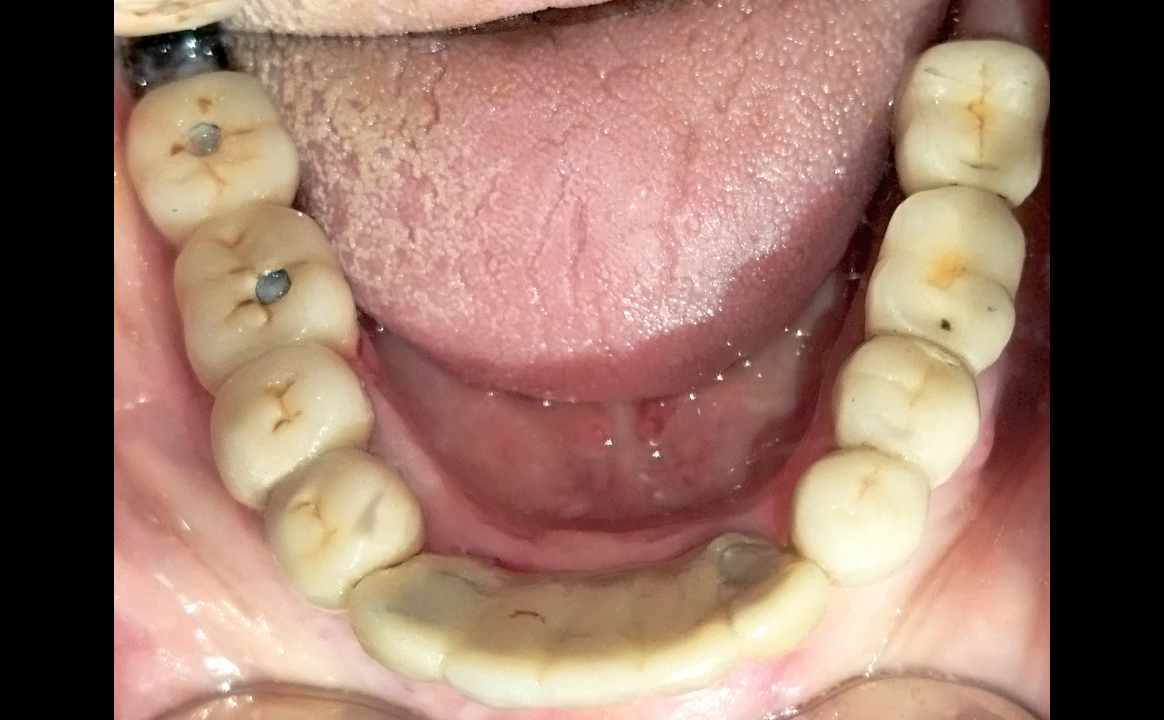 Divine Dental Dr Anirudh Rehani - Best Dentist | Dental Clinic | RCT Treatment | Dental Implant | Dental Braces In Rohini