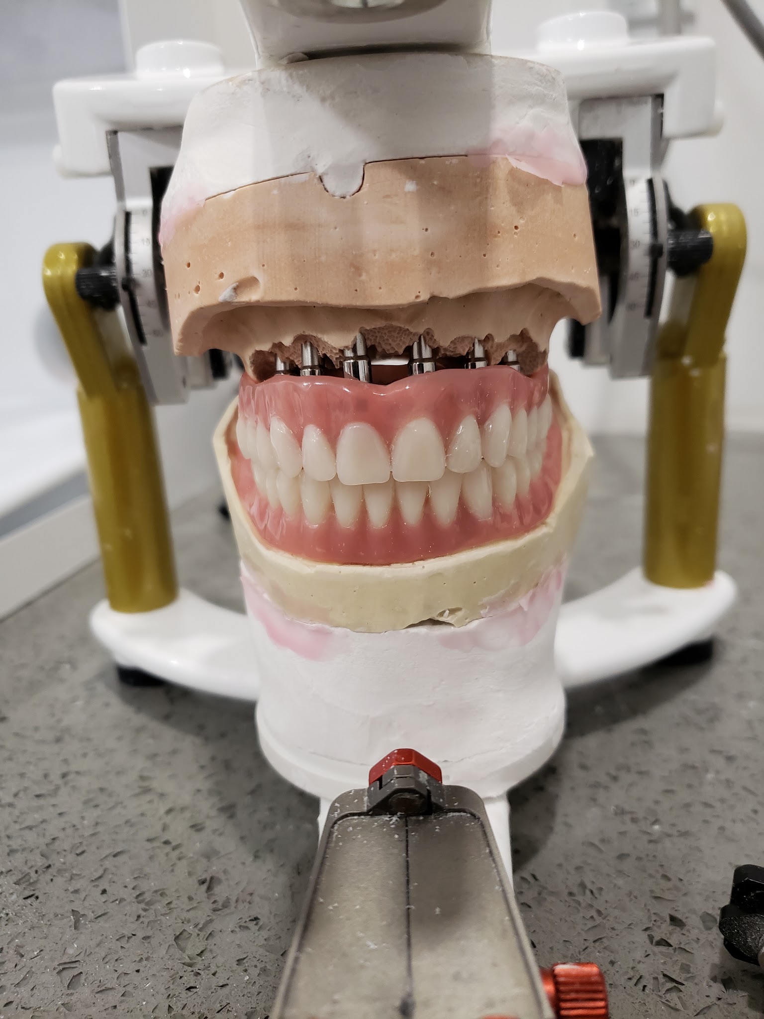 Cr Denture Centre & Implant Solutions