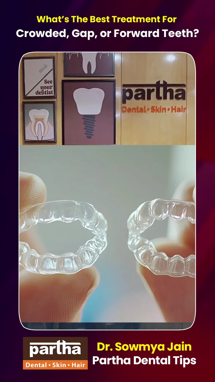 Partha Dental Clinic - Basavanagudi, Bangalore | Invisalign Provider | Braces, Root Canal & Dental Implants