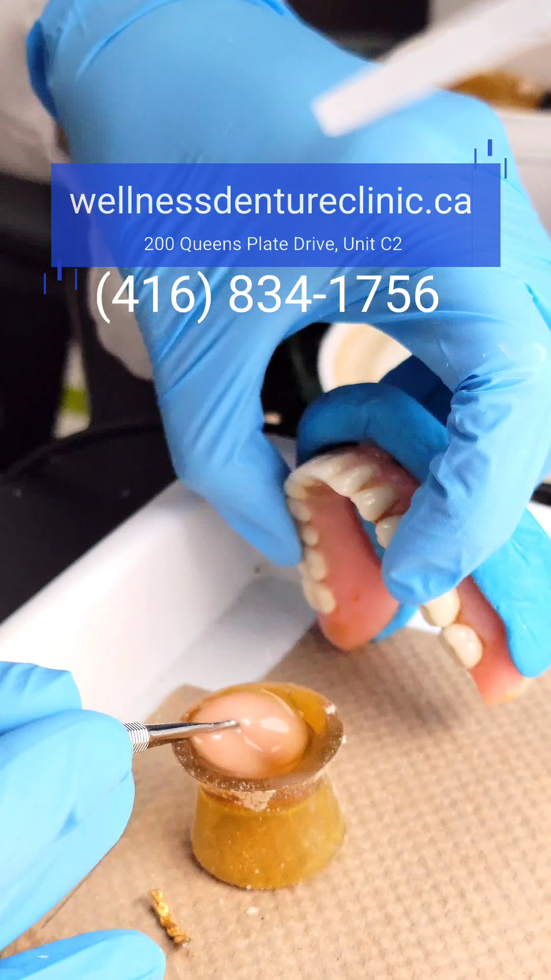 Wellness Mobile Dentures