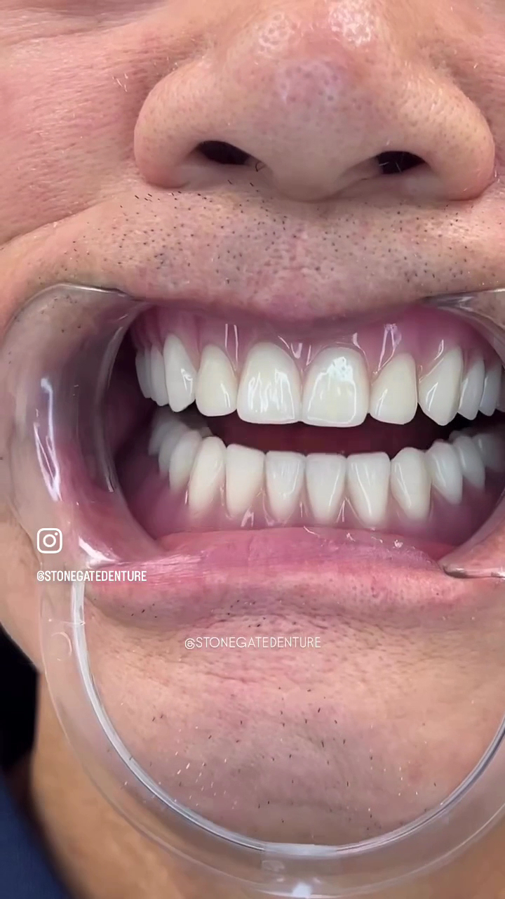 ⭐️ Stonegate Denture Clinic (House of Denture)