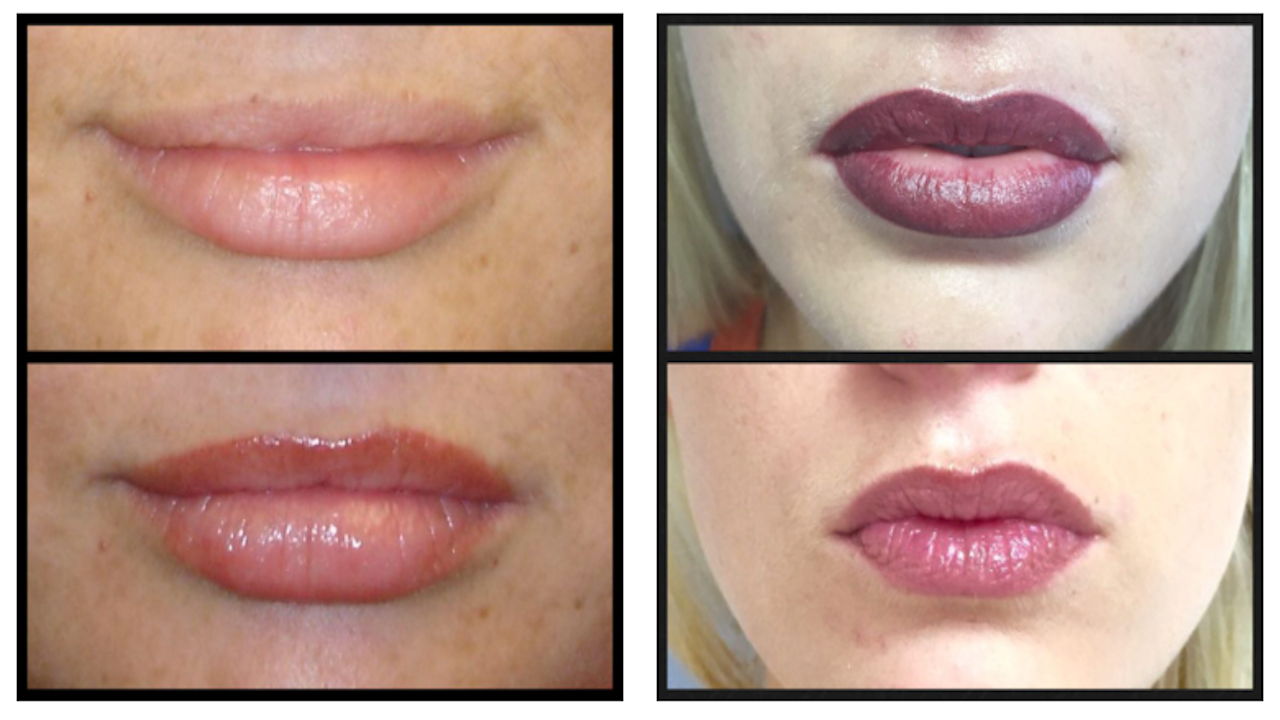 About Face Cosmetic Permanent Makeup