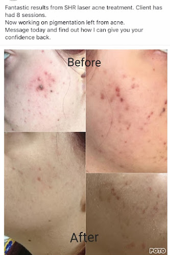 Sheer lush Aesthetics