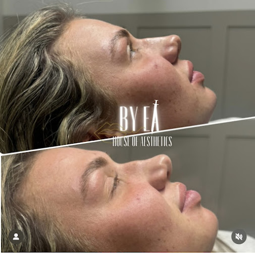 BY EA House of Aesthetics