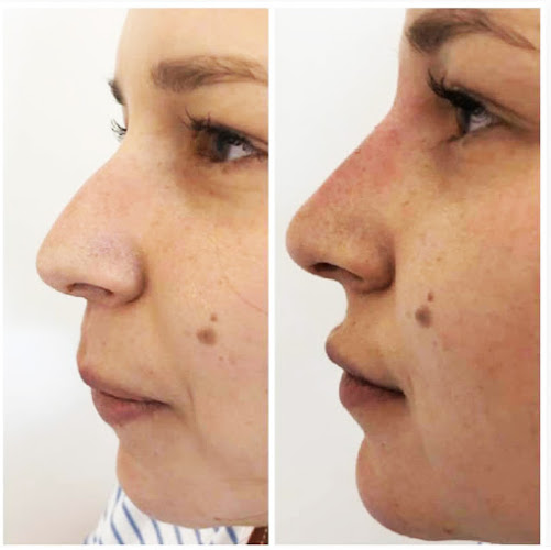 Surface Beauty medical aesthetics