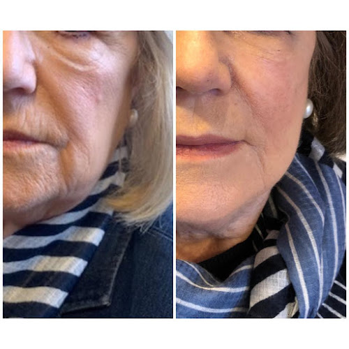 Enhanced Facial Aesthetics