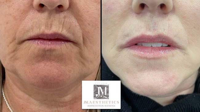 JM Aesthetics & Wellness clinic