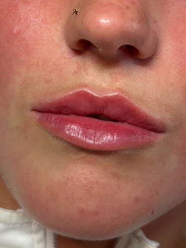 Opulent Aesthetics Corstorphine