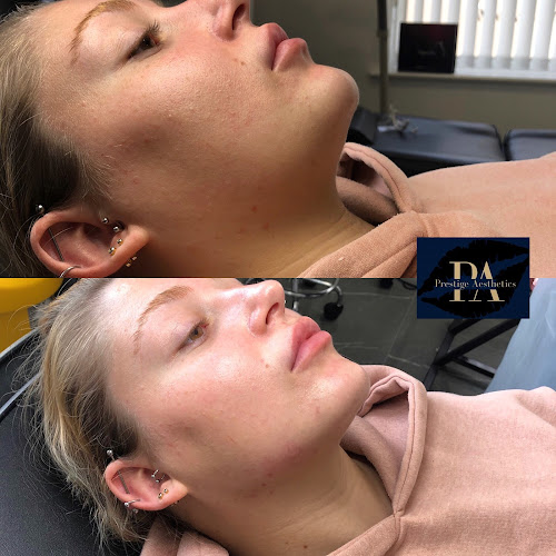 PRESTIGE AESTHETICS FALKIRK