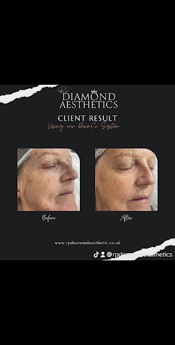 RP Diamond Aesthetics