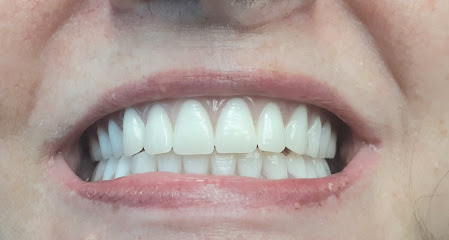 Cohen Cosmetic & Emergency Denture Clinic, EST.1982. CDCP Denture Service Plan Accepted. Expertise In Flexible Dentures.